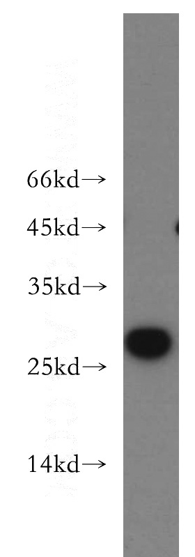 PC-3 cells were subjected to SDS PAGE followed by western blot with Catalog No:111677(IGF1B-Specific antibody) at dilution of 1:500