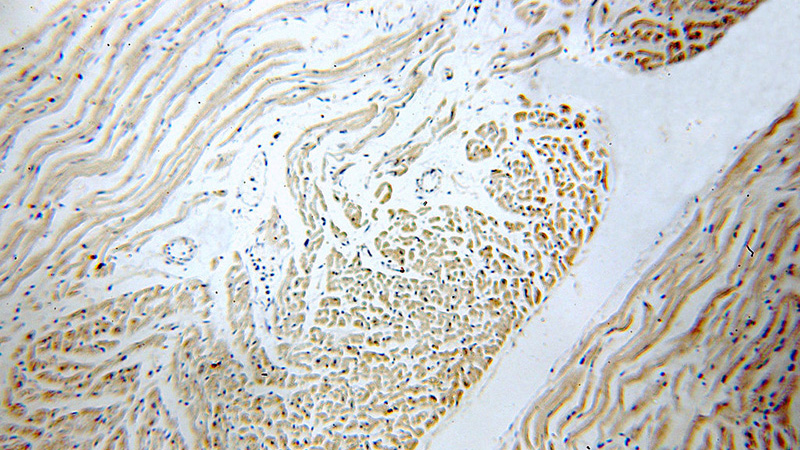 Immunohistochemical of paraffin-embedded human heart using Catalog No:110048(DocK9 antibody) at dilution of 1:100 (under 10x lens)