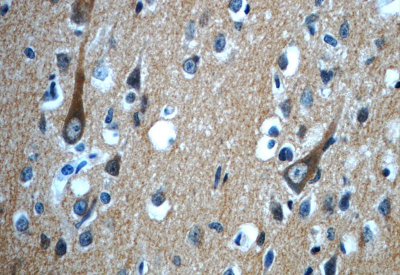 Immunohistochemistry of paraffin-embedded human brain slide using Catalog No:109510(CPLX2 Antibody) at dilution of 1:50