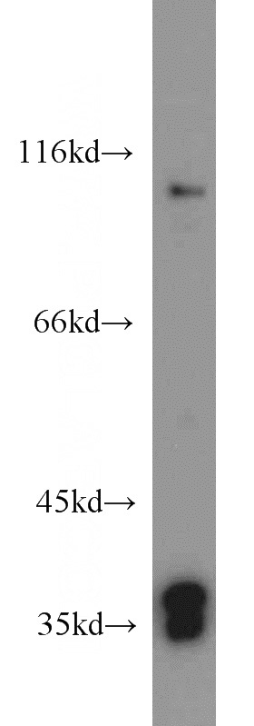 HEK-293 cells were subjected to SDS PAGE followed by western blot with Catalog No:112734(MORF4L1 antibody) at dilution of 1:500