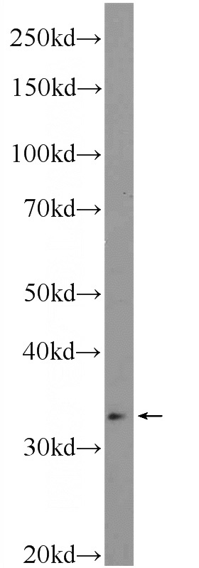 SMMC-7721 cells were subjected to SDS PAGE followed by western blot with Catalog No:111540(HOXD11 Antibody) at dilution of 1:300
