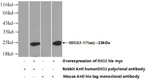Transfected HEK-293 cells were subjected to SDS PAGE followed by western blot with Catalog No:108398(B9D2 Antibody) at dilution of 1:700