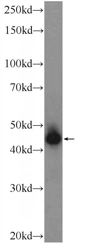 mouse brain tissue were subjected to SDS PAGE followed by western blot with Catalog No:111531(HOXB1 Antibody) at dilution of 1:300
