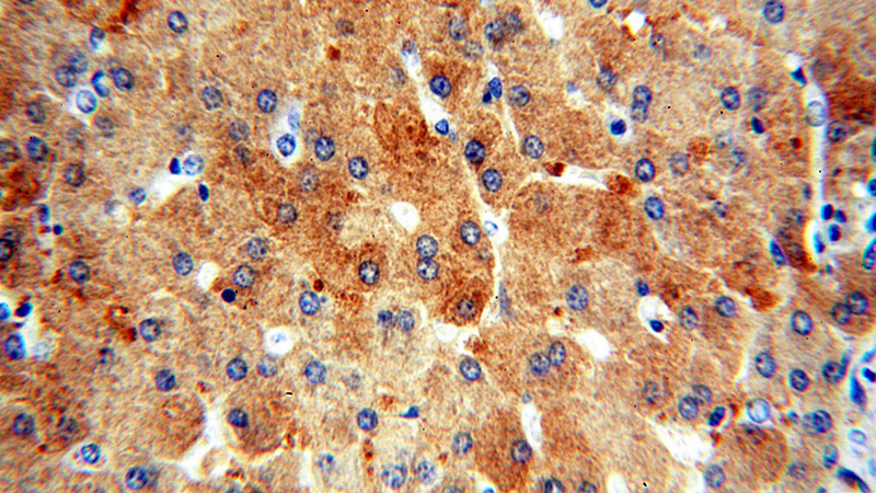 Immunohistochemical of paraffin-embedded human liver using Catalog No:107977(ALDOB antibody) at dilution of 1:100 (under 40x lens)