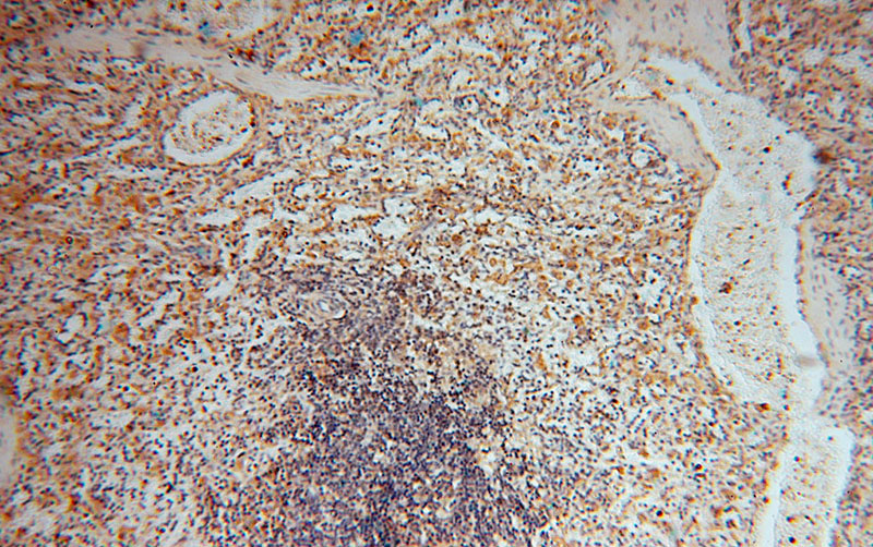 Immunohistochemical of paraffin-embedded human spleen using Catalog No:117140(BHMT antibody) at dilution of 1:100 (under 10x lens)