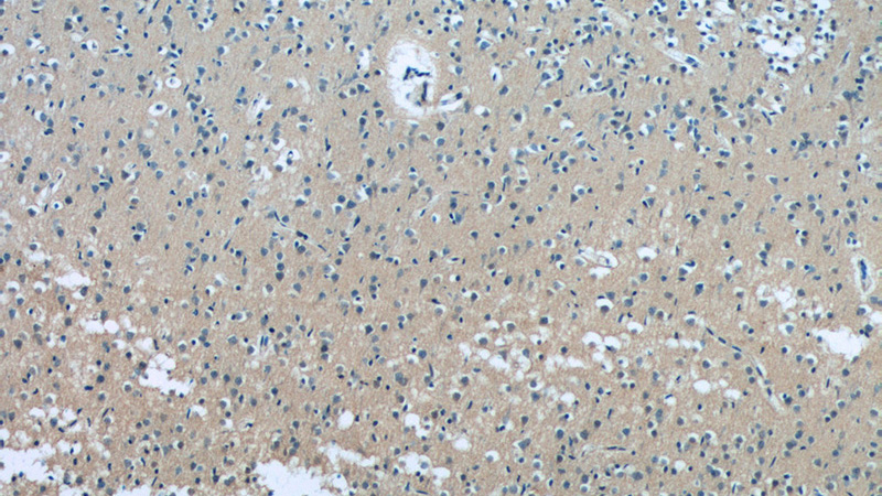 Immunohistochemistry of paraffin-embedded human brain tissue slide using Catalog No:108273(ASTN2 Antibody) at dilution of 1:50 (under 10x lens)