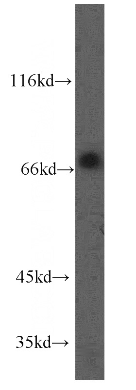 HepG2 cells were subjected to SDS PAGE followed by western blot with Catalog No:113420(ORC2L antibody) at dilution of 1:500