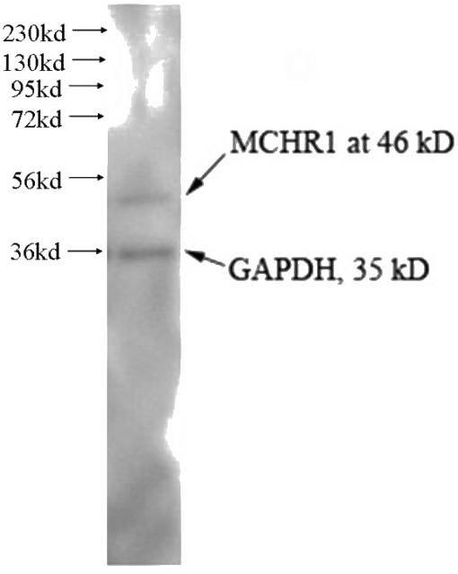 Human anterior cingulate tissue were subjected to SDS PAGE followed by western blot with Catalog No:112548 (MCHR1 antibody) at dilution of 1:1000