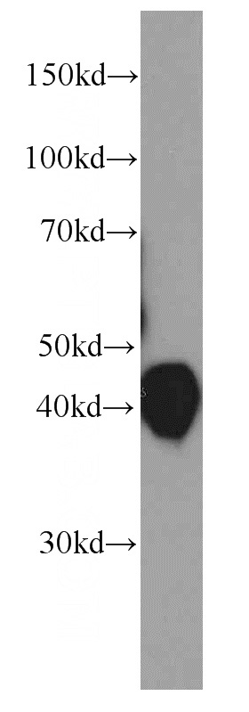 human blood tissue were subjected to SDS PAGE followed by western blot with Catalog No:107437(ORM1 antibody) at dilution of 1:2000