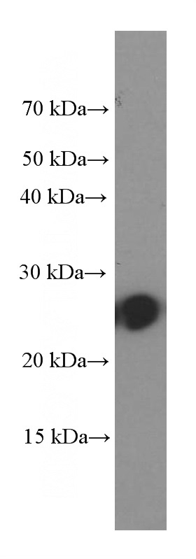 human plasma tissue were subjected to SDS PAGE followed by western blot with Catalog No:107026(C1QC Antibody) at dilution of 1:2000