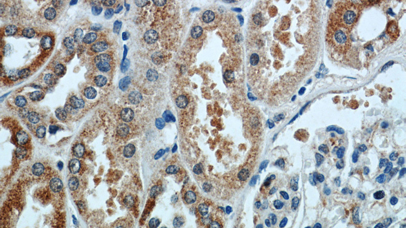 Immunohistochemistry of paraffin-embedded human kidney tissue slide using Catalog No:109780(DDX10 Antibody) at dilution of 1:50 (under 40x lens)