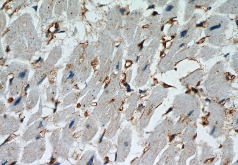 Immunohistochemistry of paraffin-embedded human heart slide using Catalog No:109723(CTGF Antibody) at dilution of 1:50