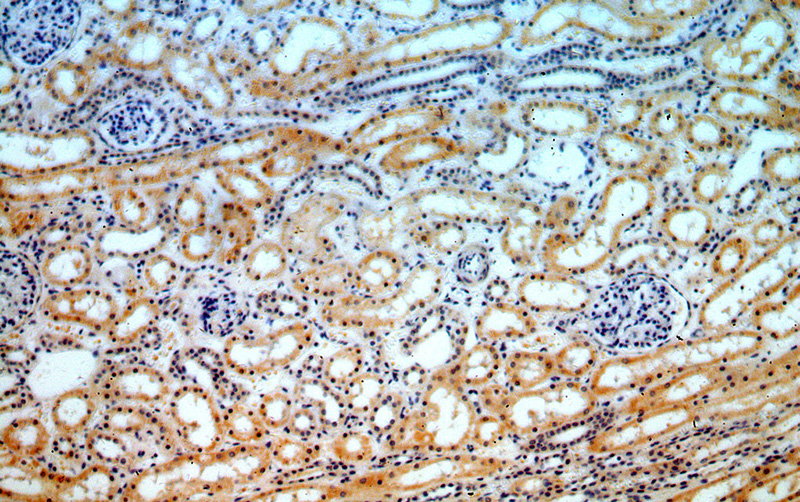 Immunohistochemical of paraffin-embedded human kidney using Catalog No:111645(IKBKG antibody) at dilution of 1:50 (under 10x lens)
