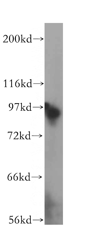 HEK-293 cells were subjected to SDS PAGE followed by western blot with Catalog No:113385(NUP93 antibody) at dilution of 1:600