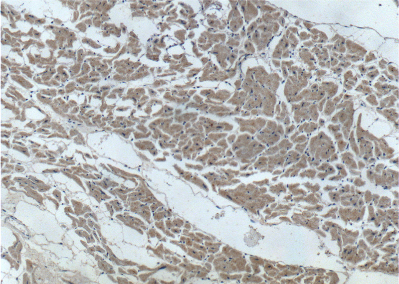 Immunohistochemistry of paraffin-embedded human heart tissue slide using Catalog No:107710(ACTN2 Antibody) at dilution of 1:200 (under 10x lens).