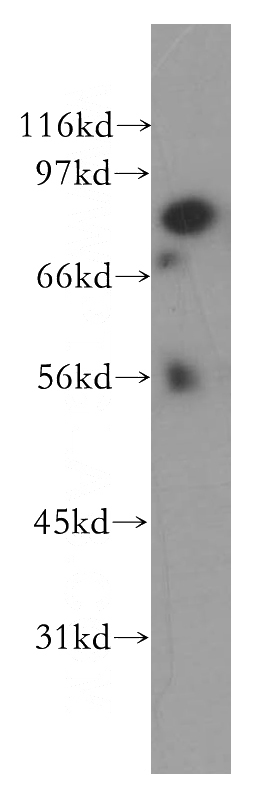 PC-3 cells were subjected to SDS PAGE followed by western blot with Catalog No:111026(QARS antibody) at dilution of 1:500