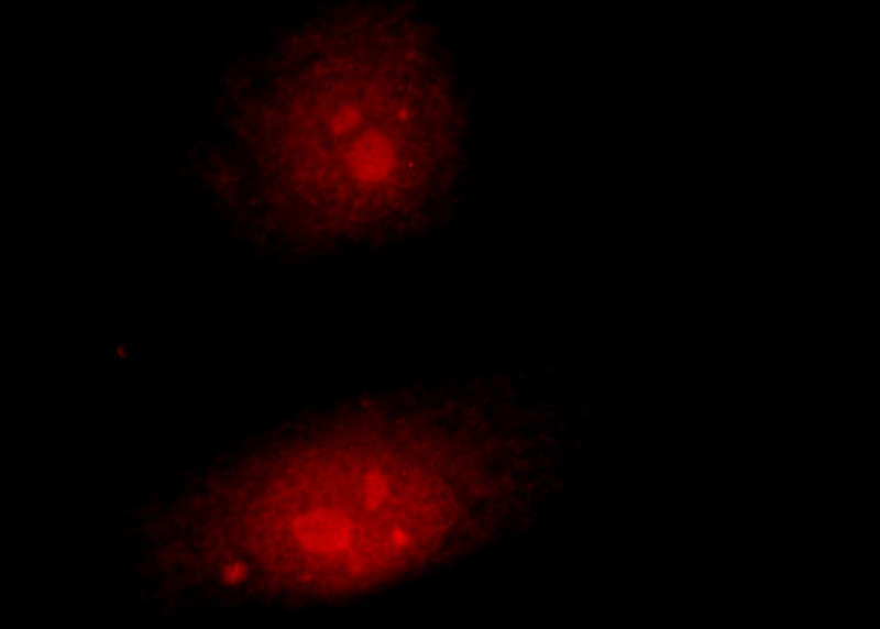 Immunofluorescent analysis of HepG2 cells using Catalog No:109335(CLSPN Antibody) at dilution of 1:50 and Rhodamine-Goat anti-Rabbit IgG