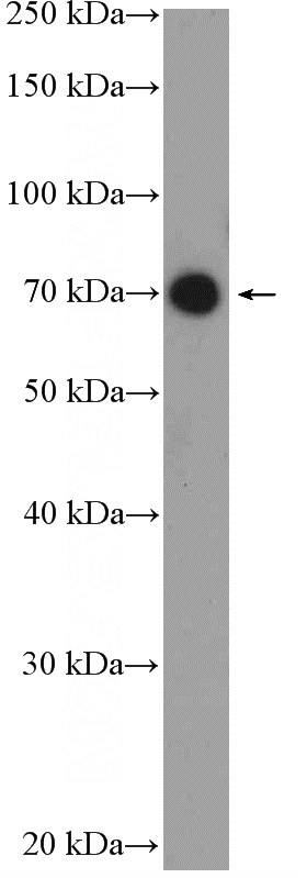 HeLa cells were subjected to SDS PAGE followed by western blot with Catalog No:116698(UTP6 Antibody) at dilution of 1:300