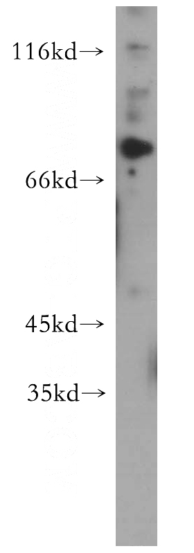 HL-60 cells were subjected to SDS PAGE followed by western blot with Catalog No:109417(MYB antibody) at dilution of 1:400