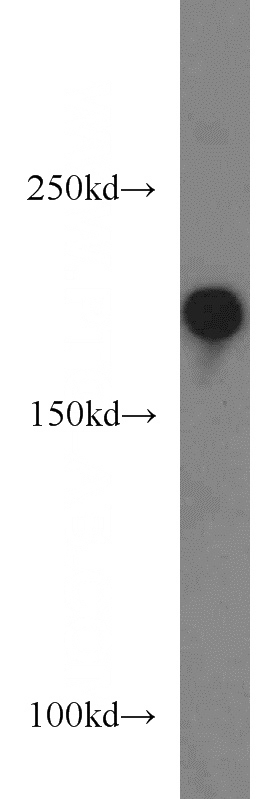 HEK-293 cells were subjected to SDS PAGE followed by western blot with Catalog No:107884(ALS2 antibody) at dilution of 1:500
