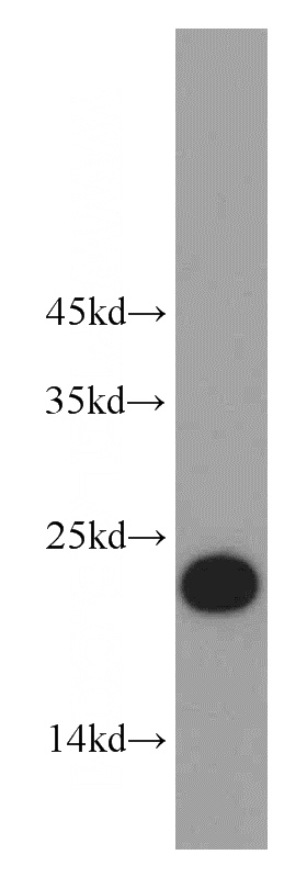 L02 cells were subjected to SDS PAGE followed by western blot with Catalog No:108791(C7orf50 antibody) at dilution of 1:500