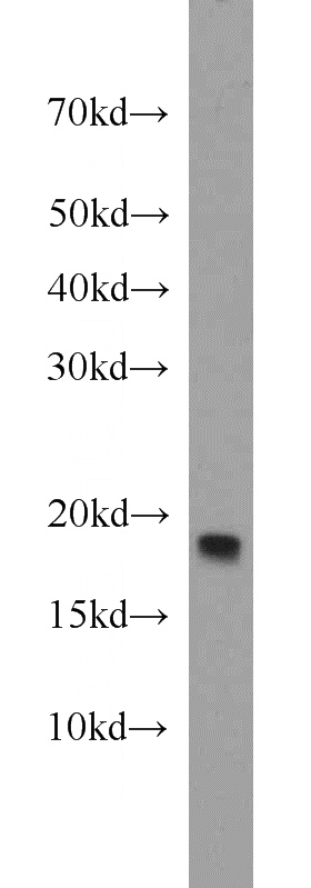 mouse skeletal muscle tissue were subjected to SDS PAGE followed by western blot with Catalog No:109859(NDUFA12 antibody) at dilution of 1:800