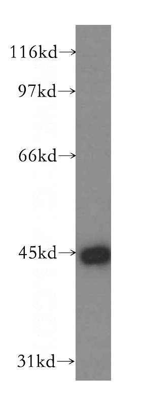 Y79 cells were subjected to SDS PAGE followed by western blot with Catalog No:115157(SFTPB antibody) at dilution of 1:500