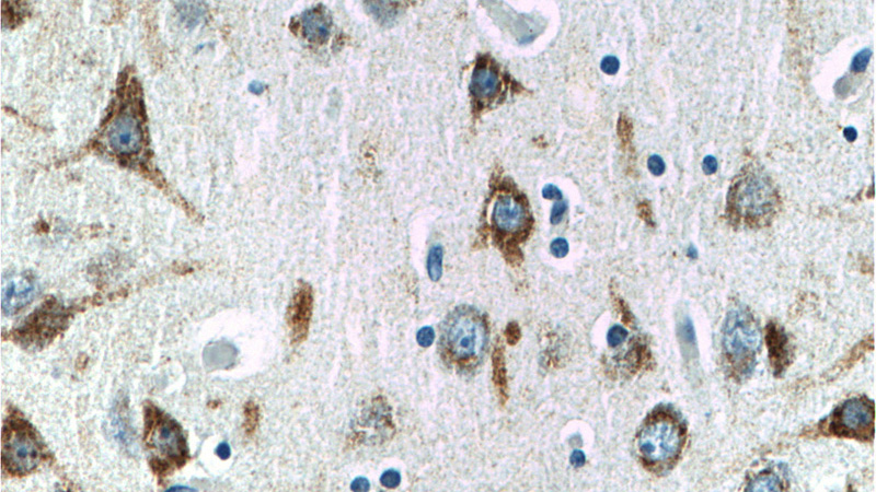 Immunohistochemistry of paraffin-embedded human brain tissue slide using Catalog No:110350(EPHA6 Antibody) at dilution of 1:200 (under 40x lens)