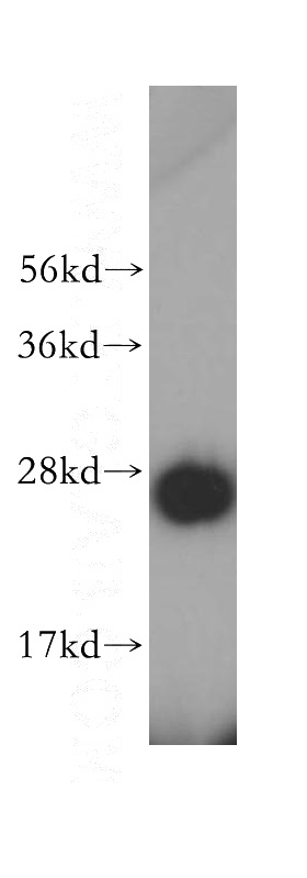 HeLa cells were subjected to SDS PAGE followed by western blot with Catalog No:110965(GHITM antibody) at dilution of 1:400