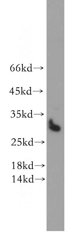 HeLa cells were subjected to SDS PAGE followed by western blot with Catalog No:115732(STOML3 antibody) at dilution of 1:500