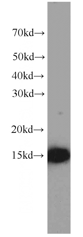 MCF7 cells were subjected to SDS PAGE followed by western blot with Catalog No:107158(CISD2-Specific antibody) at dilution of 1:1000