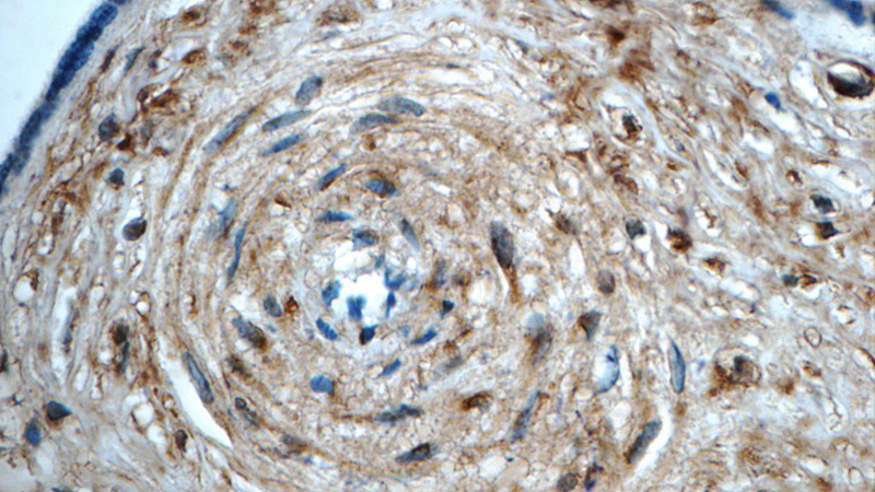 Immunohistochemistry of paraffin-embedded human placenta tissue slide using Catalog No:112202(LETM2 Antibody) at dilution of 1:50 (under 40x lens)