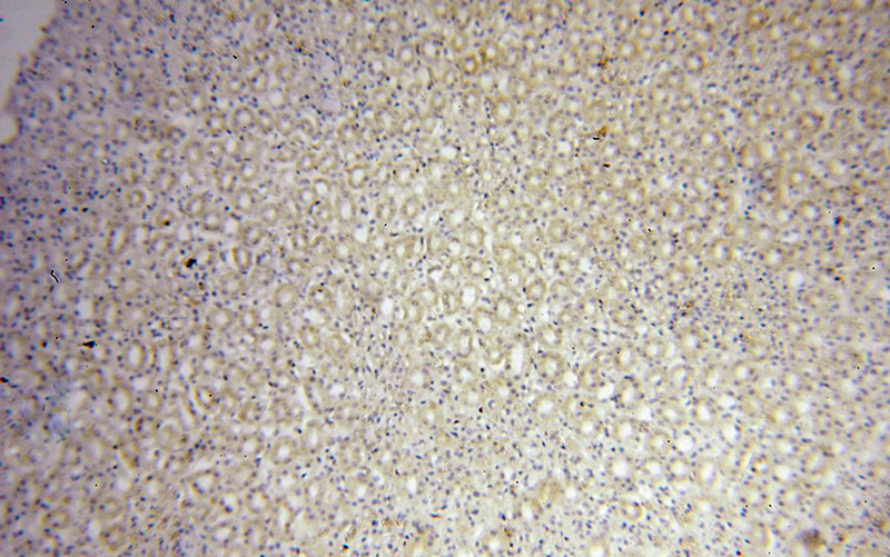 Immunohistochemical of paraffin-embedded human kidney using Catalog No:113639(PDSS2 antibody) at dilution of 1:50 (under 10x lens)