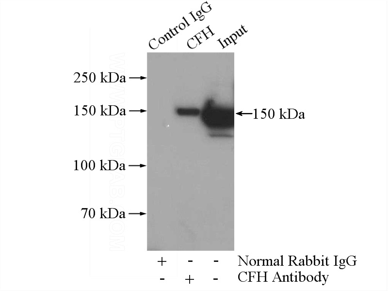 IP Result of anti-CFH (IP:Catalog No:109447, 4ug; Detection:Catalog No:109447 1:1000) with human plasma tissue lysate 4000ug.