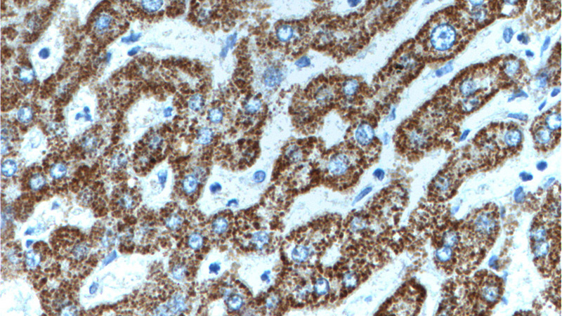 Immunohistochemistry of paraffin-embedded human liver tissue slide using Catalog No:111314(HGS Antibody) at dilution of 1:200 (under 40x lens).