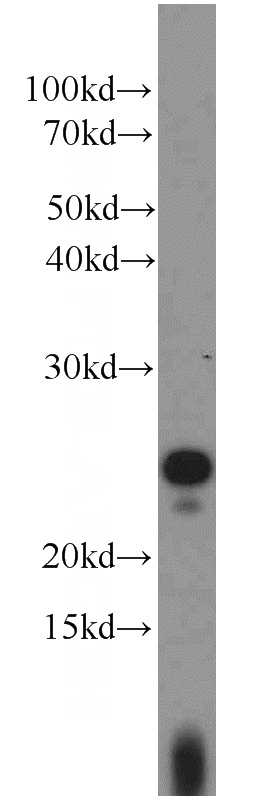 Jurkat cells were subjected to SDS PAGE followed by western blot with Catalog No:116523(UBE2E3 antibody) at dilution of 1:1000