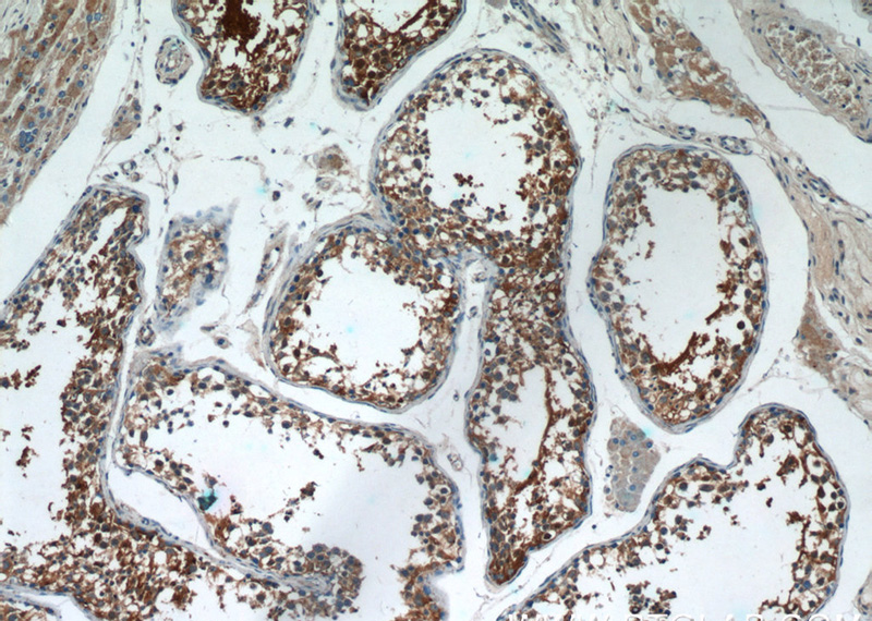 Immunohistochemistry of paraffin-embedded human testis tissue slide using Catalog No:107913(AGA Antibody) at dilution of 1:50 (under 10x lens)