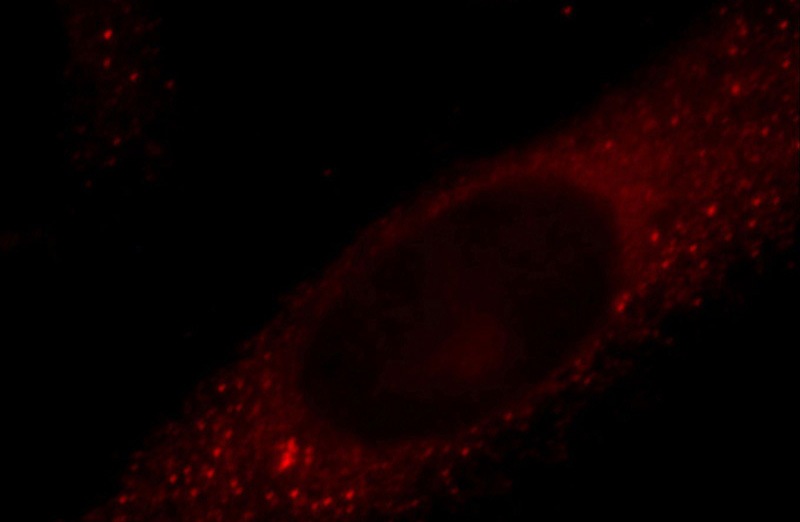 Immunofluorescent analysis of Hela cells, using TRIM2 antibody Catalog No:116302 at 1:25 dilution and Rhodamine-labeled goat anti-rabbit IgG (red).