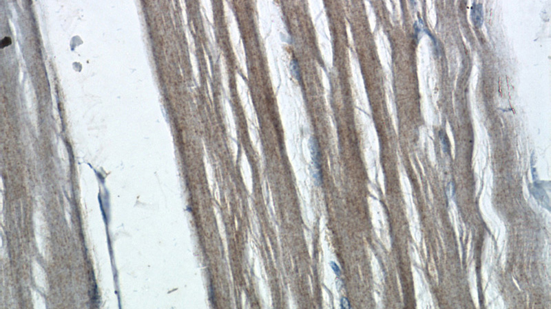 Immunohistochemistry of paraffin-embedded human skeletal muscle tissue slide using Catalog No:110566(FBXW7 Antibody) at dilution of 1:50 (under 40x lens)