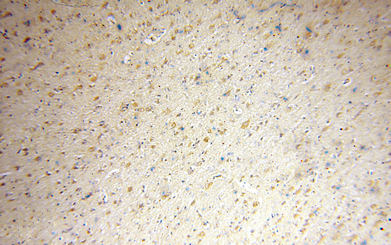 Immunohistochemical of paraffin-embedded human brain using Catalog No:107747(ACOT7 antibody) at dilution of 1:100 (under 10x lens)