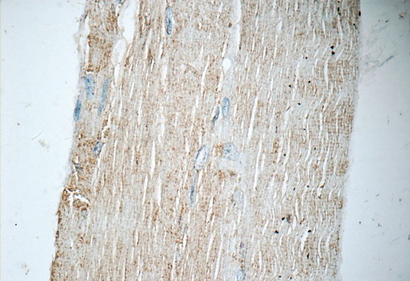 Immunohistochemistry of paraffin-embedded human skeletal muscle tissue slide using Catalog No:113391(NT5C Antibody) at dilution of 1:50 (under 40x lens)