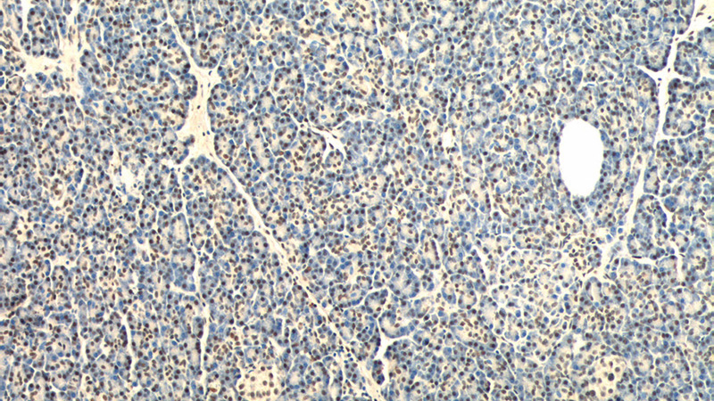Immunohistochemistry of paraffin-embedded human pancreas tissue slide using Catalog No:108140(API5 Antibody) at dilution of 1:50 (under 10x lens)