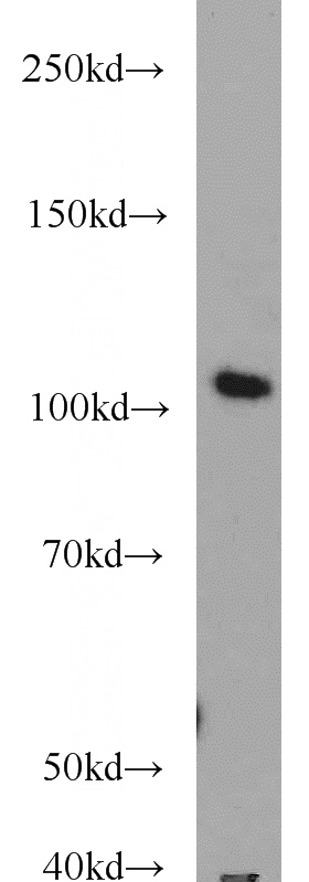 mouse liver tissue were subjected to SDS PAGE followed by western blot with Catalog No:115902(TCEB3 antibody) at dilution of 1:1000
