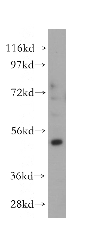HEK-293 cells were subjected to SDS PAGE followed by western blot with Catalog No:115625(ST3GAL5 antibody) at dilution of 1:500