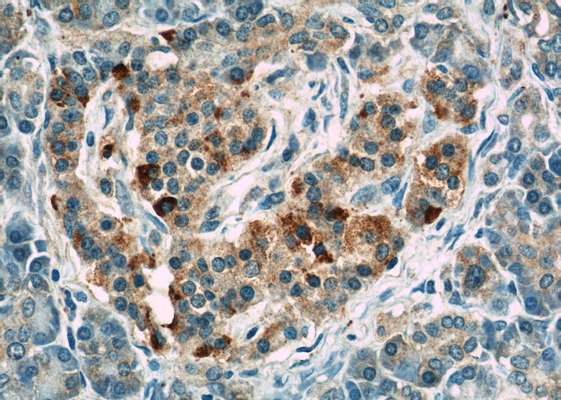 Immunohistochemistry of paraffin-embedded human pancreas slide using Catalog No:112334(LRRC47 Antibody) at dilution of 1:50