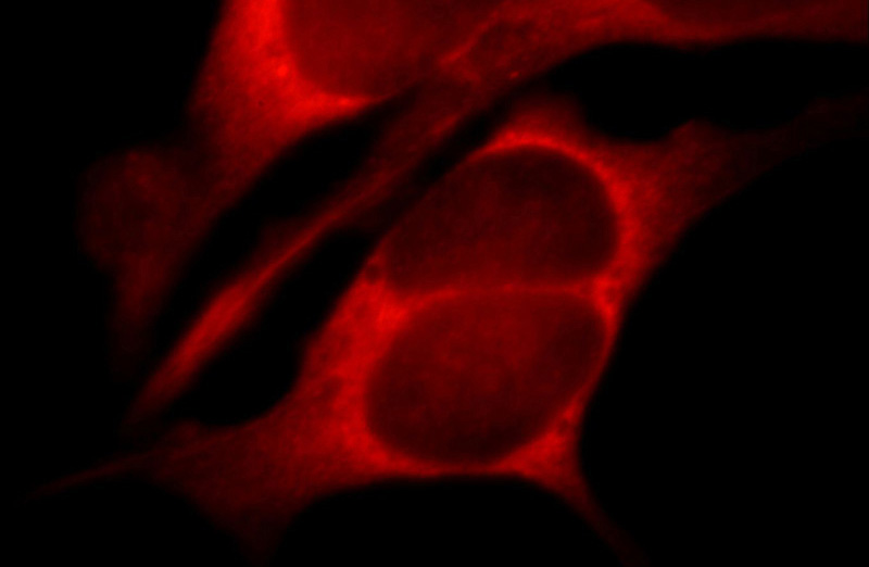 Immunofluorescent analysis of 293 cells, using ATXN2 antibody Catalog No:108280 at 1:25 dilution and Rhodamine-labeled goat anti-rabbit IgG (red).