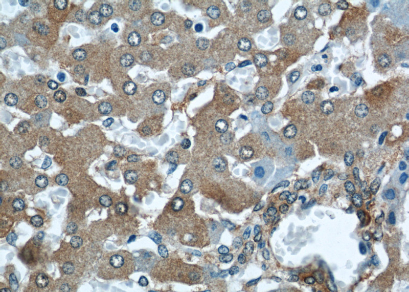 Immunohistochemical of paraffin-embedded human liver using Catalog No:107959(ALDH1A1 antibody) at dilution of 1:50 (under 40x lens)