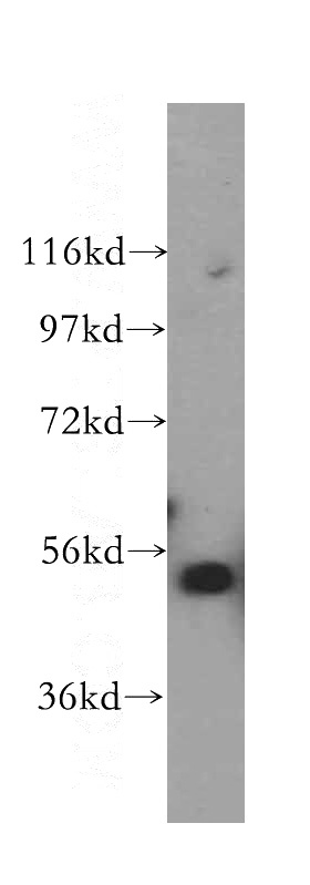 K-562 cells were subjected to SDS PAGE followed by western blot with Catalog No:114940(RUVBL2 antibody) at dilution of 1:800