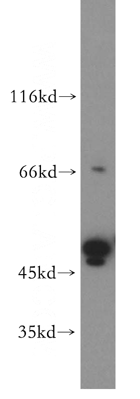 Jurkat cells were subjected to SDS PAGE followed by western blot with Catalog No:116398(TRMT5 antibody) at dilution of 1:500