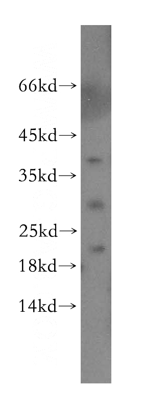 human liver tissue were subjected to SDS PAGE followed by western blot with Catalog No:110249(Endostatin, COL18A1 antibody) at dilution of 1:300